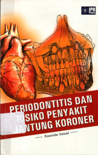 Periodontitis & Risiko Penyakit Jantung Koroner
