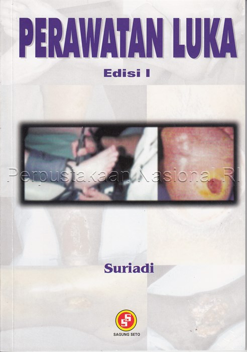 Perawatan Luka (4)