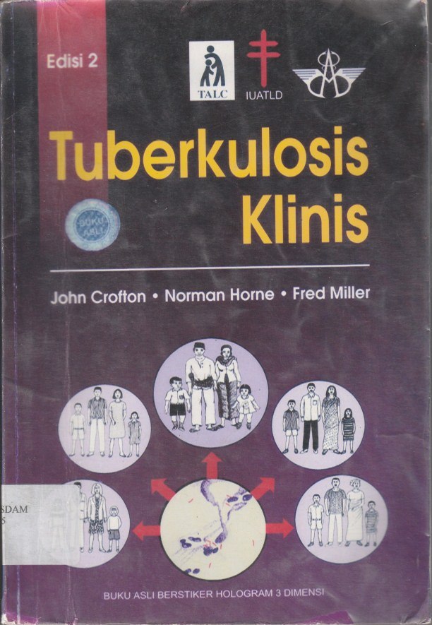 Tuberkolosis klinis